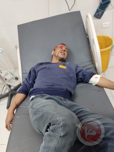 One injury occurred in a settler attack on citizens’ homes south of Hebron
