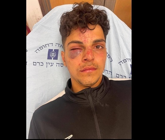 Settlers assault a young Jerusalemite