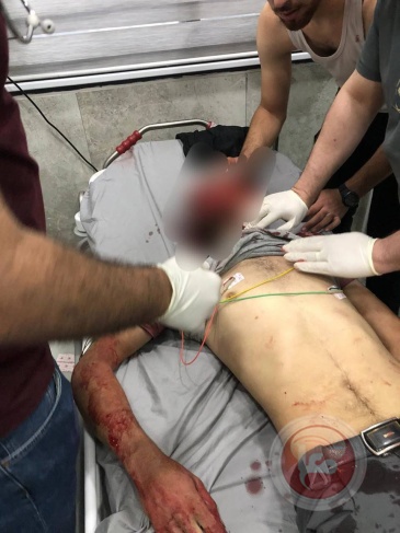 ثلاثة شهداء ..بعد 13 ساعة جيش الاحتلال يعلن انتهاء اقتحام جنين