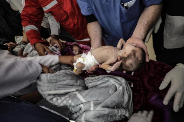 &quot;اليونيسف&quot; تدعو إلى هدنة 7 أيام في غزة لتلقيح 640 ألف طفل ضد شلل الأطفال