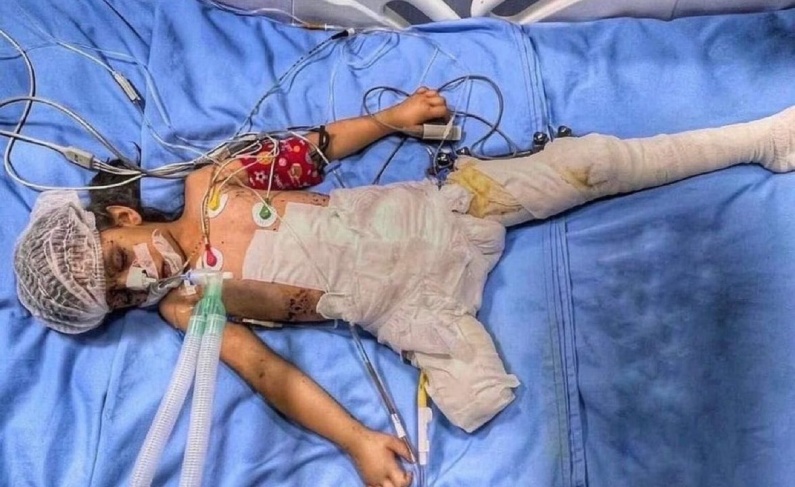 الأمم المتحدة: 70% من ضحايا العدوان على غزة هم من الأطفال والنساء