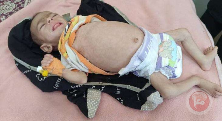 تقرير حقوقي يوثق الارتفاع الحاد بمعدلات الوفاة الطبيعية في قطاع غزة 