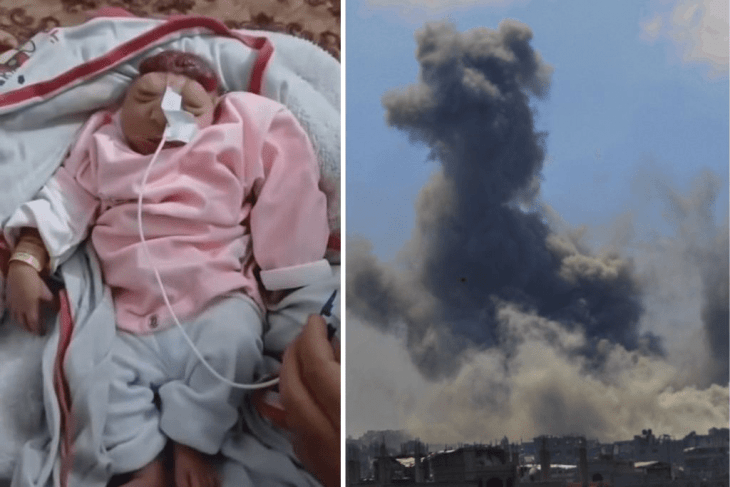 ولادة طفلة &quot;بلا دماغ&quot; مع تزايد ظاهرة &quot;تشوه الأجنة&quot; في قطاع غزة