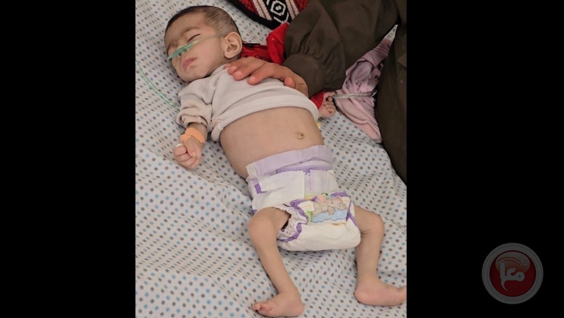 استشهاد طفلة في غزة بسبب المجاعة ما يرفع الحصيلة إلى 54