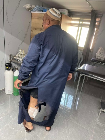 جنود الاحتلال يهاجمون المصلين بعد صلاة الجمعة في بيت أمر واصابة مواطن بحروق