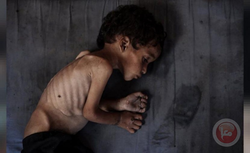 الأغذية العالمي: شخص من كل 3 بغزة لا يتناول الطعام أياما