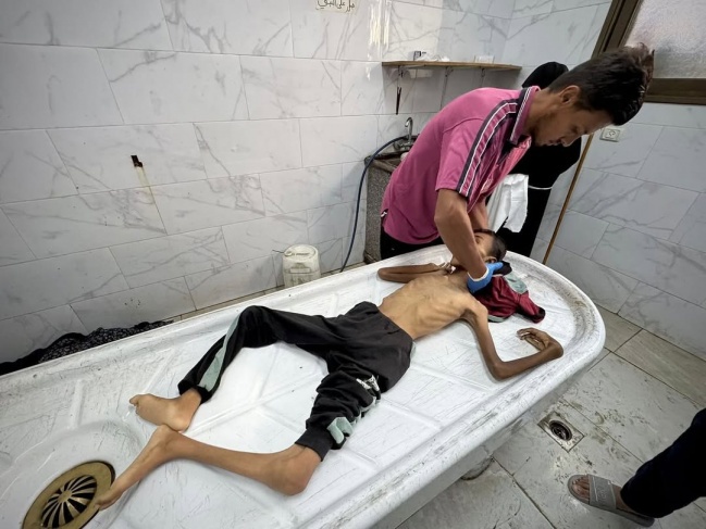 في غضون 24 ساعة: وفاة 10 أشخاص بسبب المجاعة وسوء التغذية في قطاع غزة