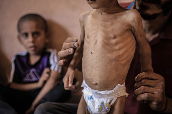 هآرتس: جدعون ساعر &quot;وزير التجويع&quot; خانق غزة