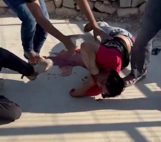 لحظة إصابة الشاب عودة الهذالين في مسافر يطا