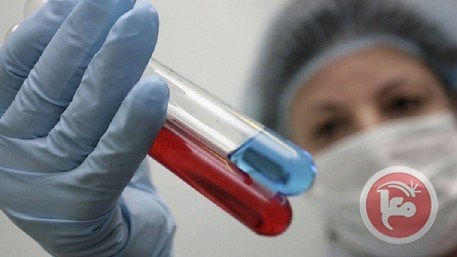 العلماء يكتشفون أسباب جلطات الدم التي تقتل مرضى كورونا