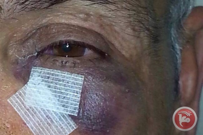 مستوطنون يعتدون على مواطن