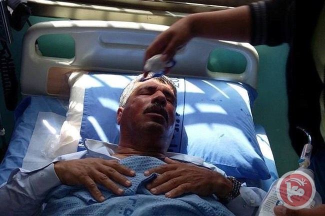 15 اصابة بقمع الاحتلال لمسيرة يوم الارض بنابلس