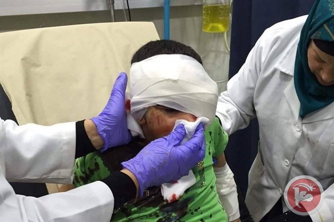 اصابة طفل بجراح خطيرة في شعفاط