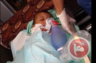 استشهاد رضيع حرقا واصابة عائلته في هجوم للمستوطنين