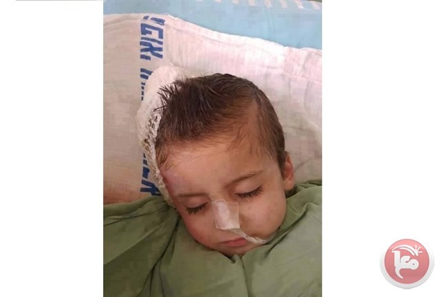 &lt;div&gt;صورة وتعليق: &lt;/div&gt;وبقي احمد وحيدا بعد رحيل الام والاب والاخ حرقا