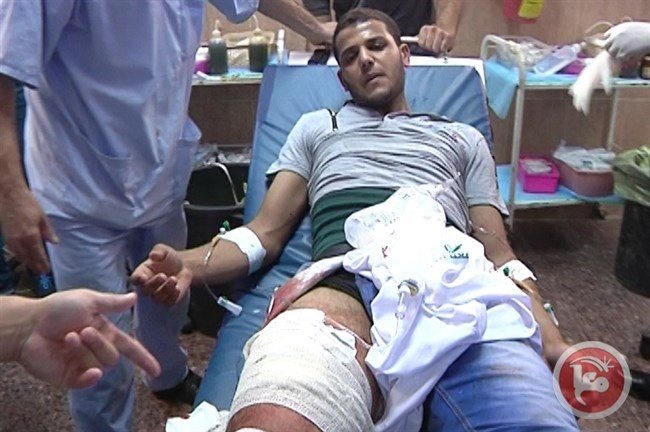 عشرات الإصابات بالرصاص الحي بينهم 3 حرجة في مواجهات حوارة