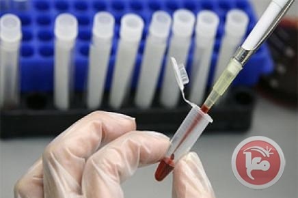 86 مصابا بالايدز في فلسطين