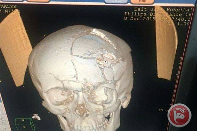 الرصاصة التي قتلت مالك شاهين