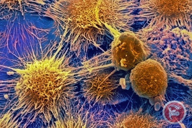 علماء: السرطان سيصبح امرا اعتياديا مؤسفا بالمستقبل