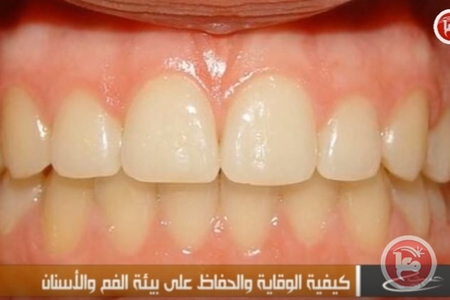 تعرَّفْ على أسوأ 9 أمور تضرُّ بأسنانك