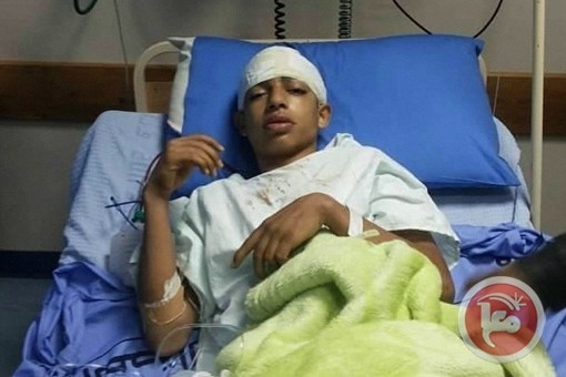 الحركة العالمية: الاحتلال يستهدف الأجزاء العليا من أجساد الأطفال