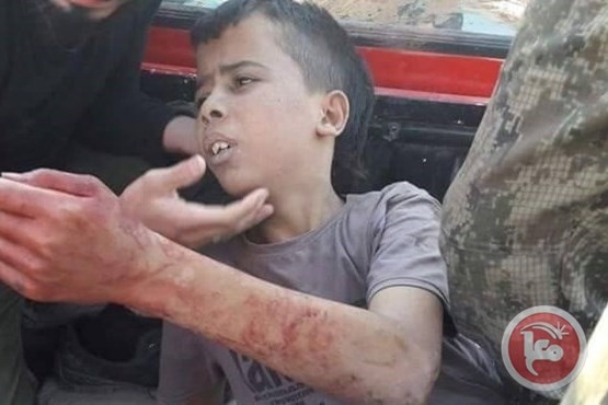 مقاتلو الجيش الحر يذبحون طفلاً فلسطينياً شمال حلب