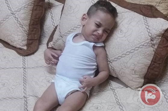 والد طفل مريض يناشد الرئيس ووزير الصحة
