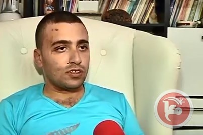 7 إصابات بالرصاص الحي في مخيم الدهيشة