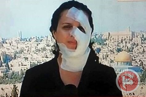 بعد اغلاق ملف التحقيق.. الصحفية محاميد تتابع ملف إصابتها