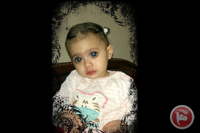 مواطن من غزة يناشد انقاذ طفلتيه من فقدان البصر