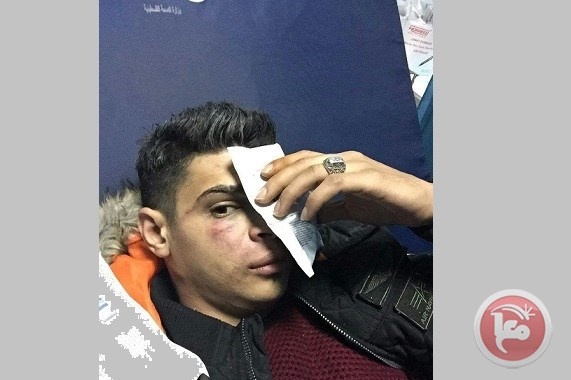 جيش الاحتلال يعتدي على شاب من نابلس على جسر &quot;اللنبي&quot;