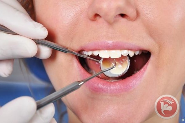 علماء يطورون حشوا للأسنان يجعلها تلتأم تلقائيا
