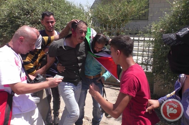 اصابة 7 مواطنين بمواجهات مع الاحتلال في كفر قدوم