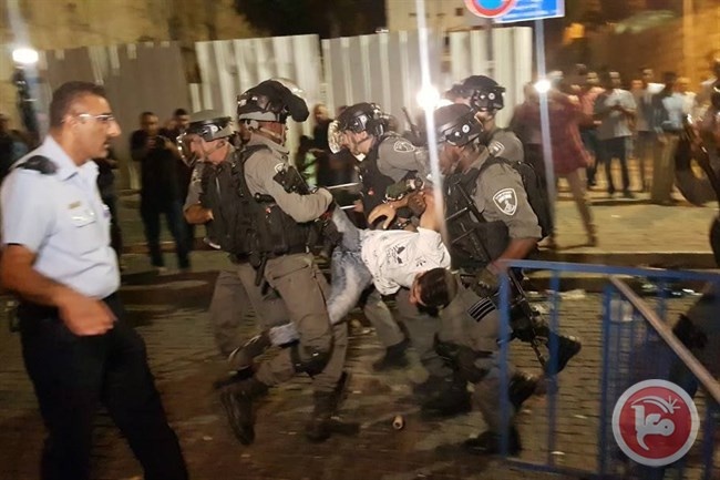 حصيلة - 79 إصابة في القدس