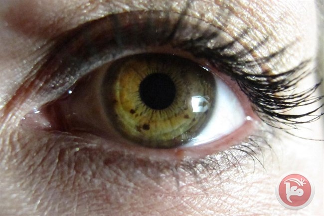 بقع قزحية العين قد تكون علامة على أمراض تسببها الشمس