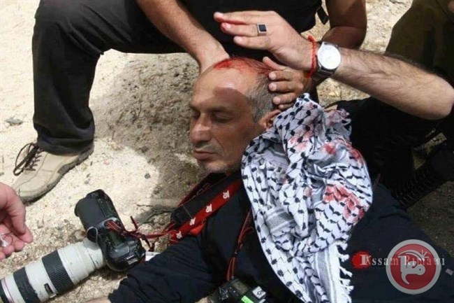 اصابة المصور الصحافي ناصر الشيوخي
