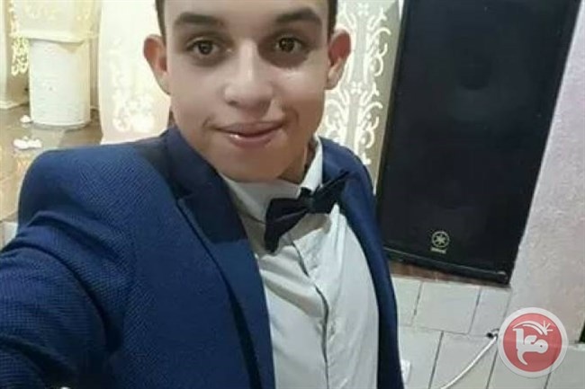 الطفل الجريح المصري في غيبوبة ووضعه الصحي خطير