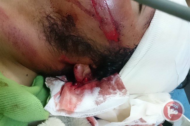 مستوطنون يعتدون على شاب ووالدته