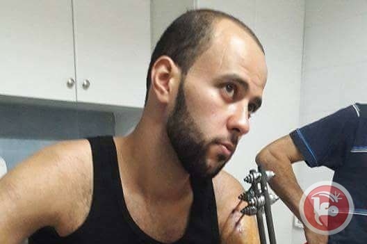 جنود الاحتلال اعتدوا على مصاب خلال اعتقاله