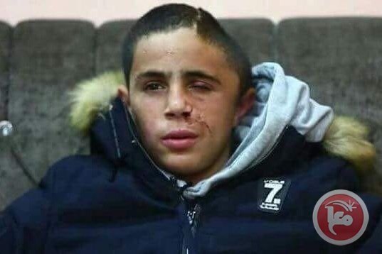 الاحتلال يعتقل طفلا جريحا من النبي صالح
