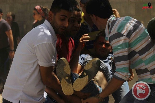 اصابة شاب برصاص الاحتلال بالرأس في كفر قدوم