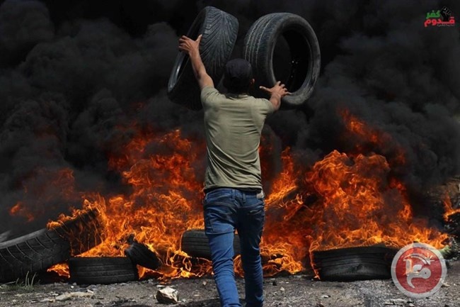 اصابة شاب برصاص الاحتلال في كفر قدوم
