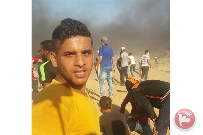 شهيد متأثرا باصابته في غزة