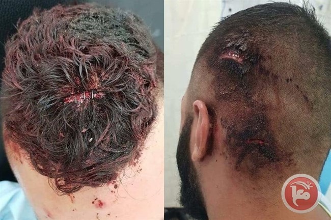 اعتقال مشبوه ثالث بالاعتداء على شبان شفا عمرو