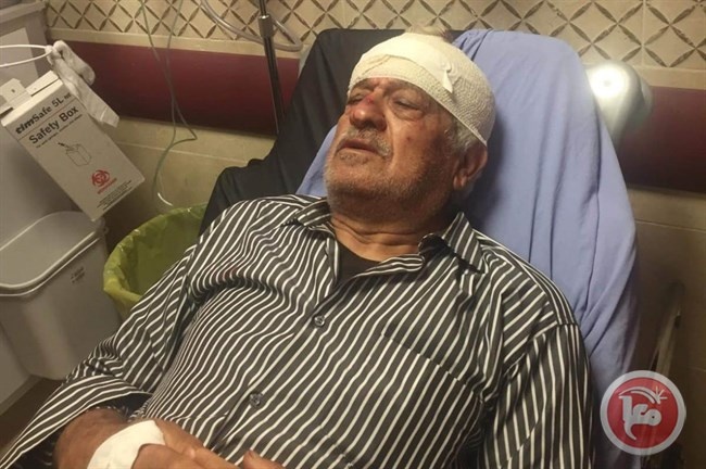 إصابة مسن بجروح إثر اعتداء مستوطنين عليه