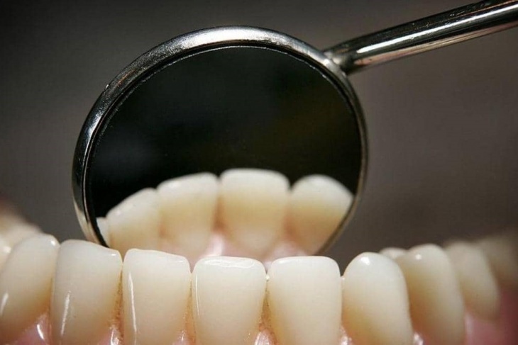 عادات خاطئة تدمر أسنانك.. تخلص منها
