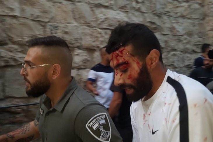 صور- اصابات واعتقالات خلال اعتداء الاحتلال على المقدسيين