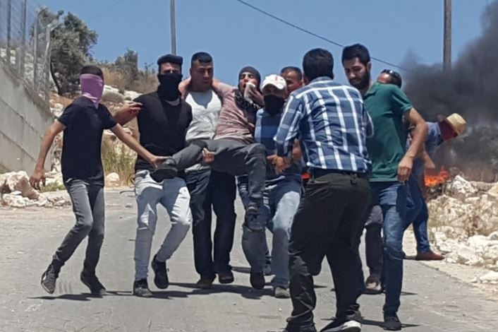 10 اصابات برصاص الاحتلال في كفر قدوم