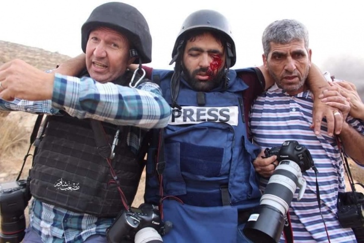 فيديو- اصابة صحفي بعينه خلال تغطيته مواجهات بالخليل