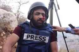 حماس: الاحتلال يتعمّد استهداف الإعلاميين لطمس جرائمه